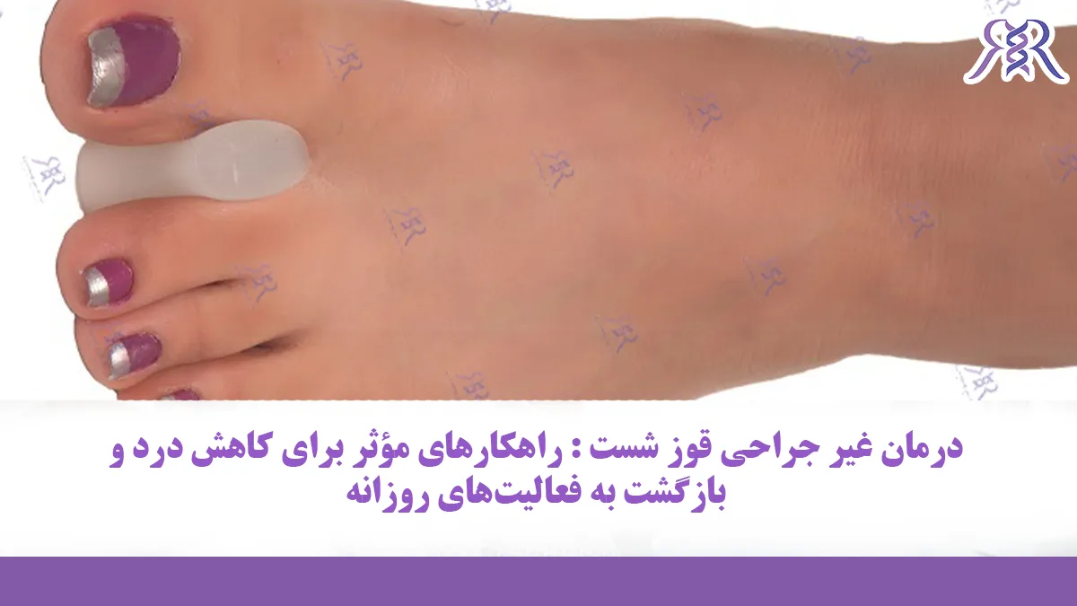 درمان غیر جراحی قوز شست : راهکارهای مؤثر برای کاهش درد و بازگشت به فعالیت‌های روزانه